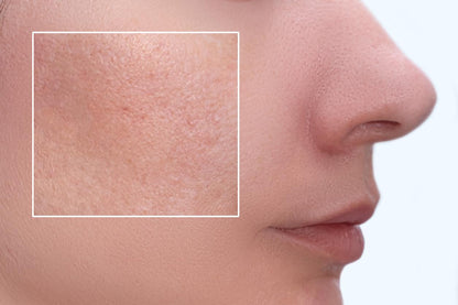 serum reductor de poros piel mas suave🌟